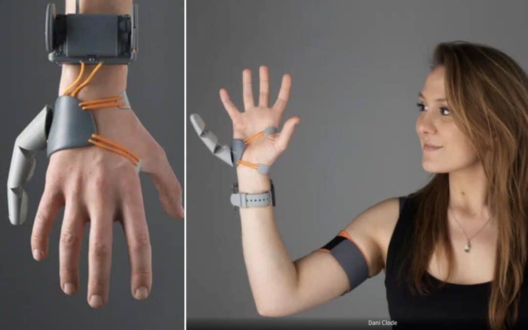 This woman just created a robotic third thumb and it’s a total gamechanger